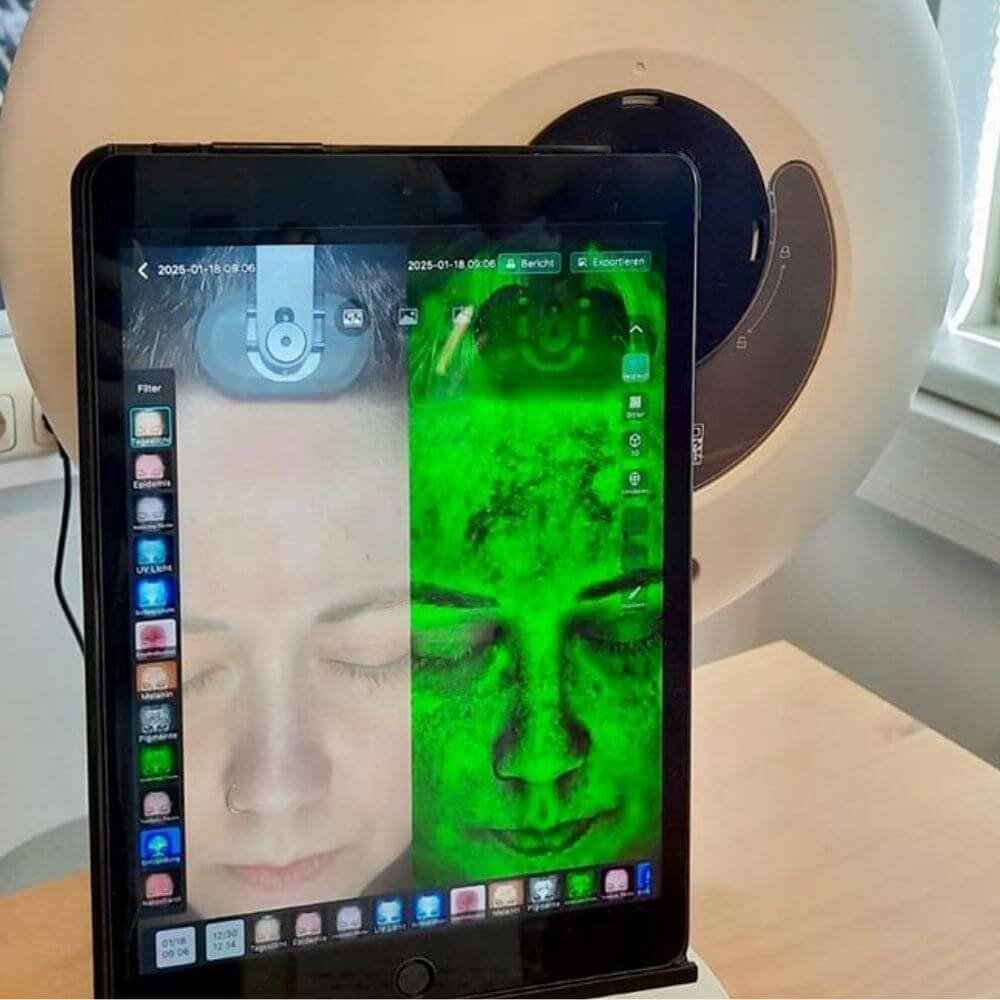 Professionelle Tiefenhautanalyse mit Hautanalysegerät im Kosmetikstudio Iris Kosmetik in Wiener Neustadt